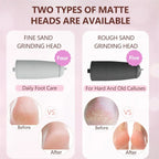 Eliminador de callos