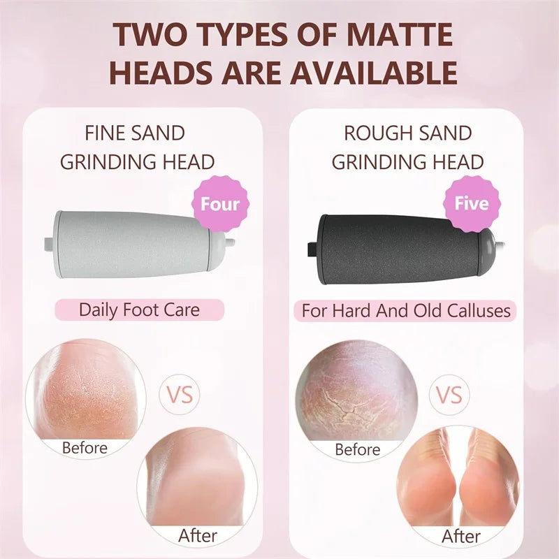 Eliminador de callos